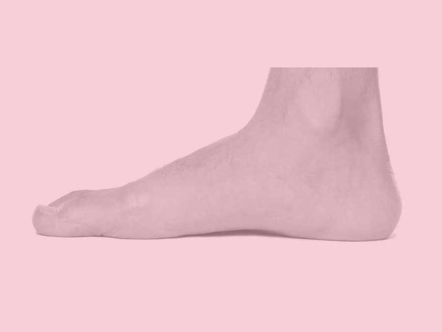 Adult Aquired Flat Foot